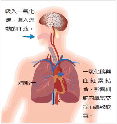 一氧化碳中毒圖2